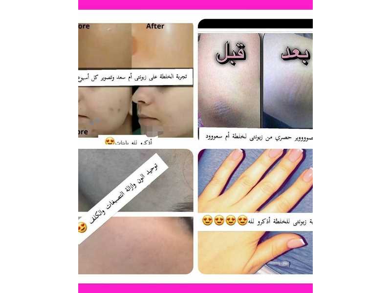 متجر العنايه بالبشره